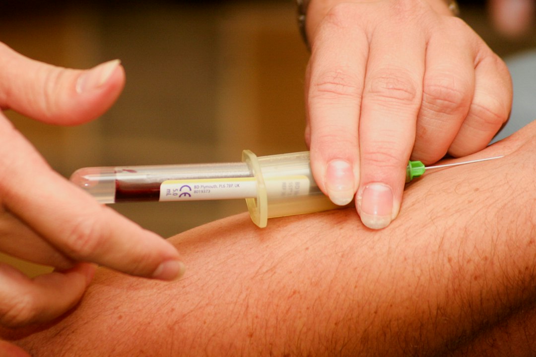 Check-up ve koruyucu sağlık değerlendirmesinde tansiyon ve temel sağlık ölçümleri; EPC Hastanesi