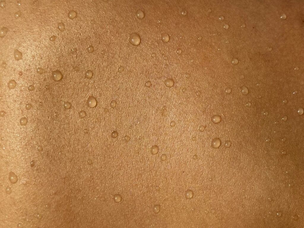 Cilt mantarı, kaşıntılı ve pullu deri lezyonları hakkında dermatoloji bilgilendirme görseli; EPC Hastanesi