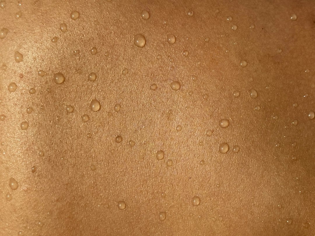 Cilt mantarı, kaşıntılı ve pullu deri lezyonları hakkında dermatoloji bilgilendirme görseli; EPC Hastanesi