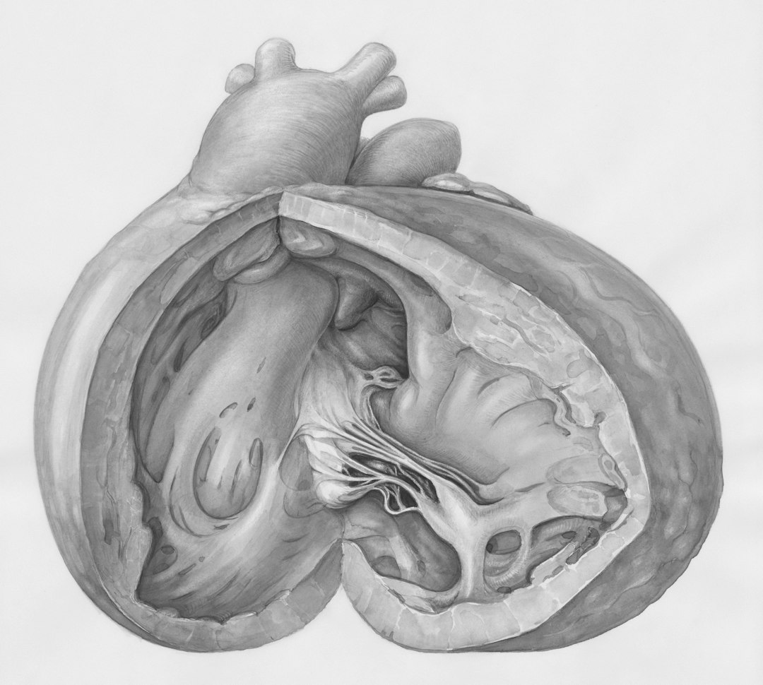Hipertansiyonun kalp ve damar sistemiyle ilişkisini gösteren tıbbi anatomik görsel; EPC Hastanesi