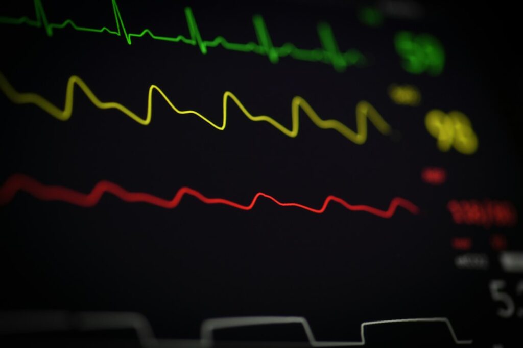 Kalp yaşı ve damar yaşı değerlendirmesini temsil eden EKG monitörü; EPC Hastanesi