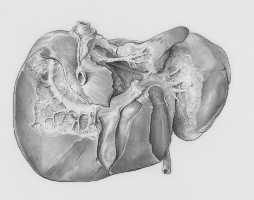 Karaciğer anatomisini gösteren tıbbi görsel; karaciğer yağlanması bilgilendirmesi EPC Hastanesi