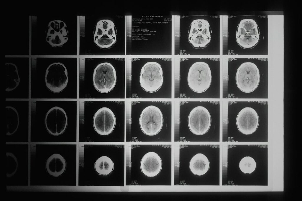 Serebral BT anjiyo ve beyin damarlarının bilgisayarlı tomografi ile görüntülenmesi hakkında EPC Hastanesi bilgilendirme görseli